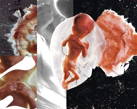 are gory anti-choice photos fake
